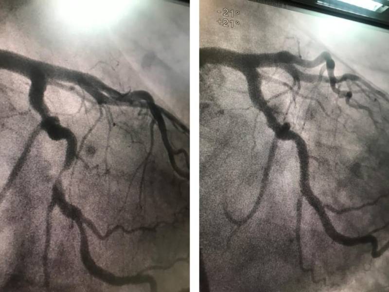 Líneas de desnudo. 117.  El ángel que siempre va conmigo. Manuel&nbsp;Pérez-Petit