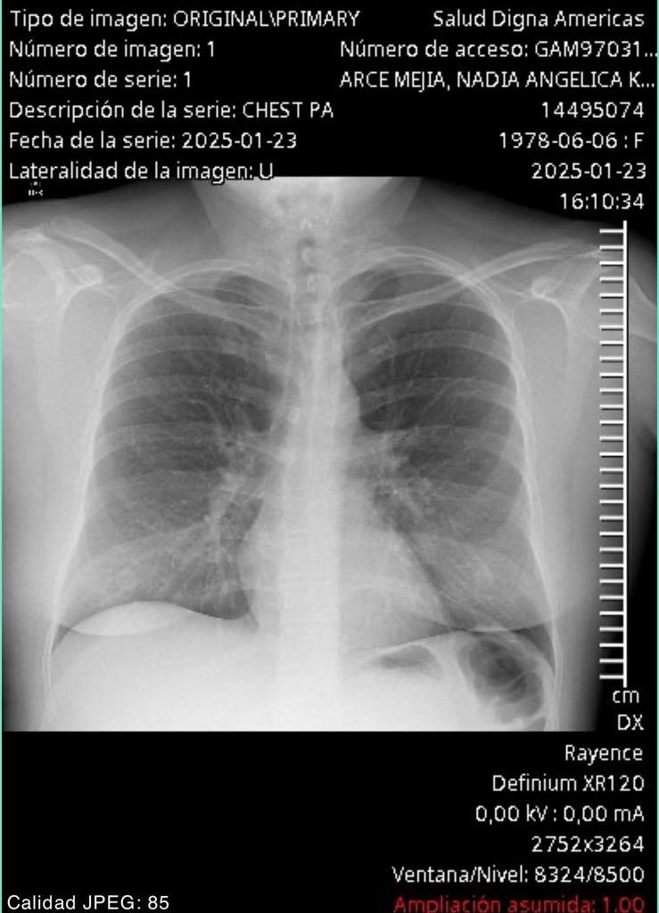 Fotografía: Nadia Arce.